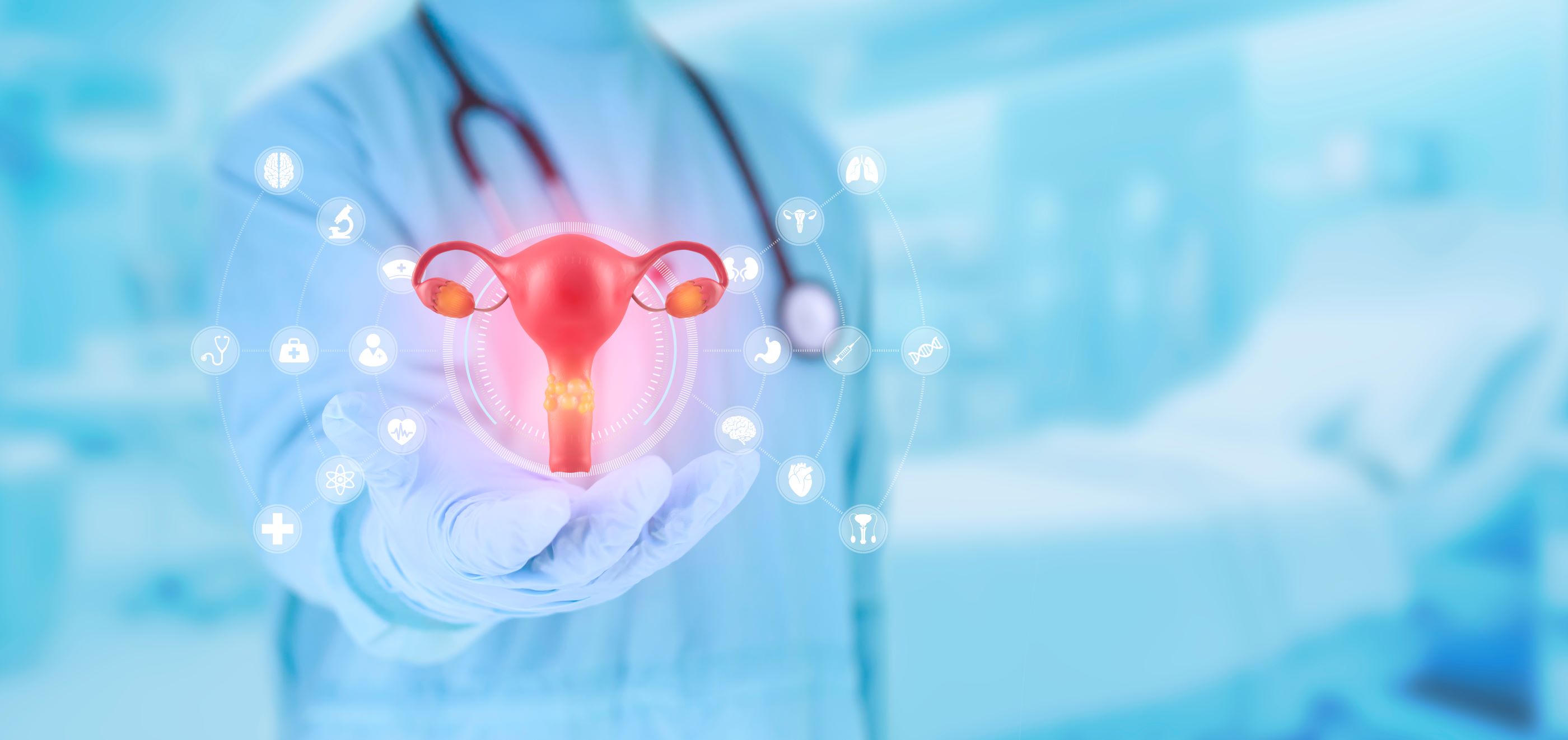 OMONDO SANTÉ : Scandale médical en Suède : révélations sur des ablations injustifiées de l'utérus